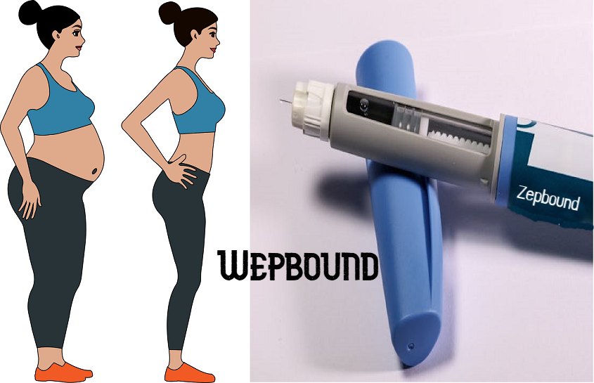 Wepbound